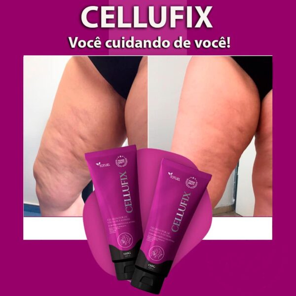 Cellufix - Gel Anticelulite, estrias e gordura localizada.