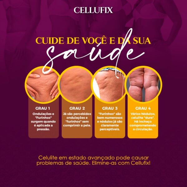 Cellufix - Gel Anticelulite, estrias e gordura localizada.